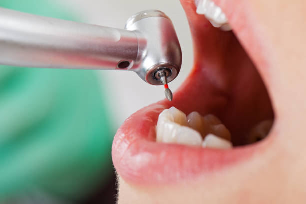 Best Emergency TMJ Treatment in Adelphi, MD